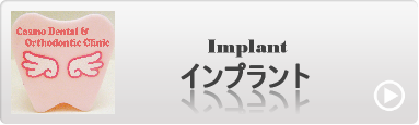 インプラント